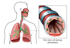 哮喘为何会演变成肺气肿